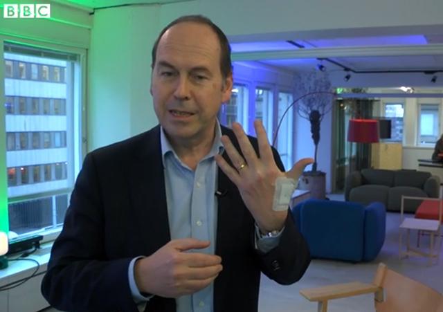Escritório insere chips em funcionários para evitar senhas e cartões